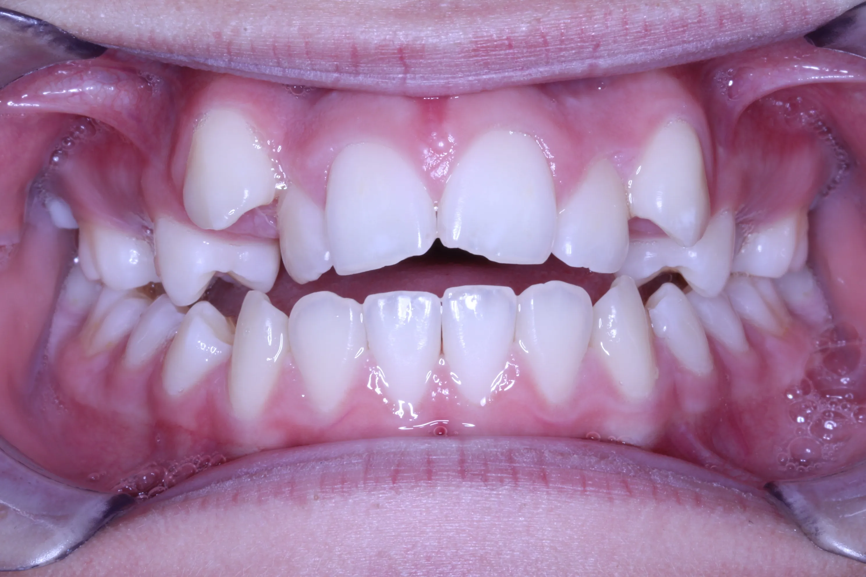 smile-gallery gallery